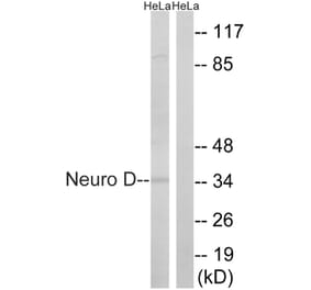 Western Blot - Anti-Neuro D Antibody (B8383) - Antibodies.com