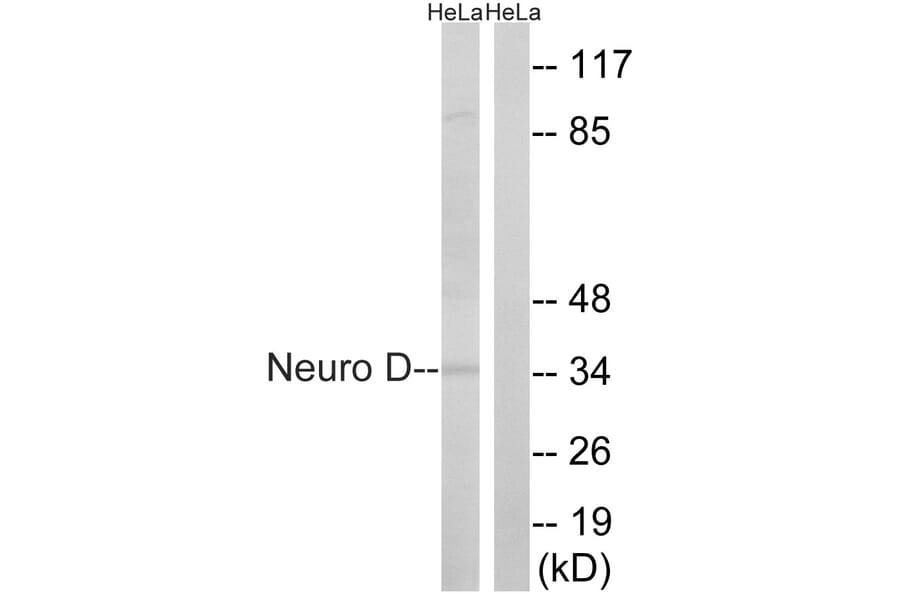Western Blot - Anti-Neuro D Antibody (B8383) - Antibodies.com