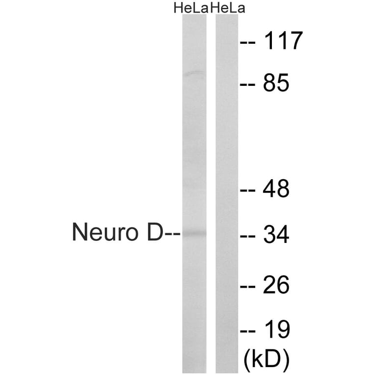 Western Blot - Anti-Neuro D Antibody (B8383) - Antibodies.com