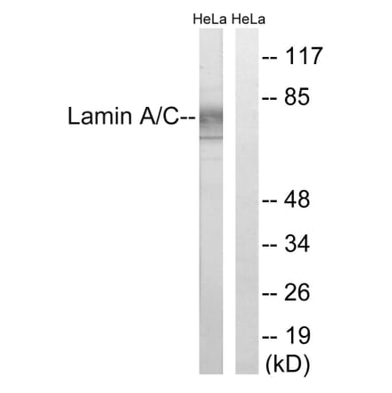Western Blot - Anti-Lamin A Antibody (B8464) - Antibodies.com