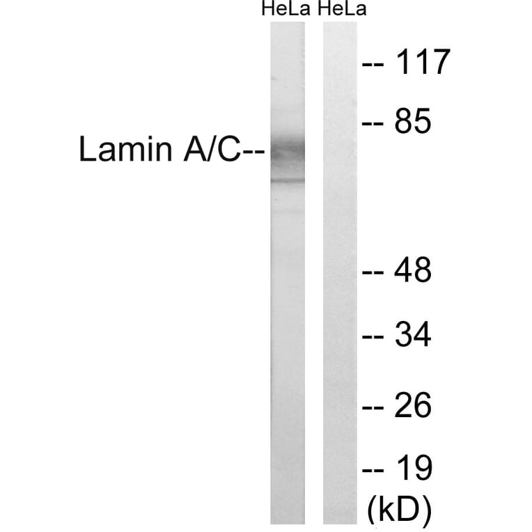 Western Blot - Anti-Lamin A Antibody (B8464) - Antibodies.com