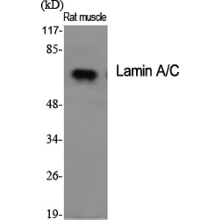 Western Blot - Anti-Lamin A Antibody (B8464) - Antibodies.com