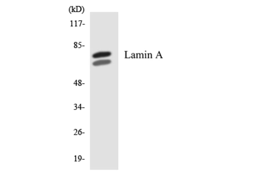 Western Blot - Anti-Lamin A Antibody (R12-2960) - Antibodies.com