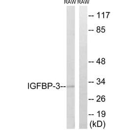 Western Blot - Anti-IGFBP-3 Antibody (B1052) - Antibodies.com