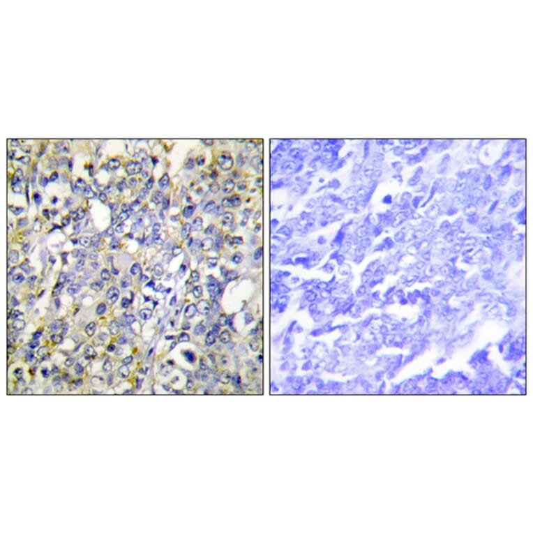 Immunohistochemistry - Anti-IGFBP-3 Antibody (B1052) - Antibodies.com