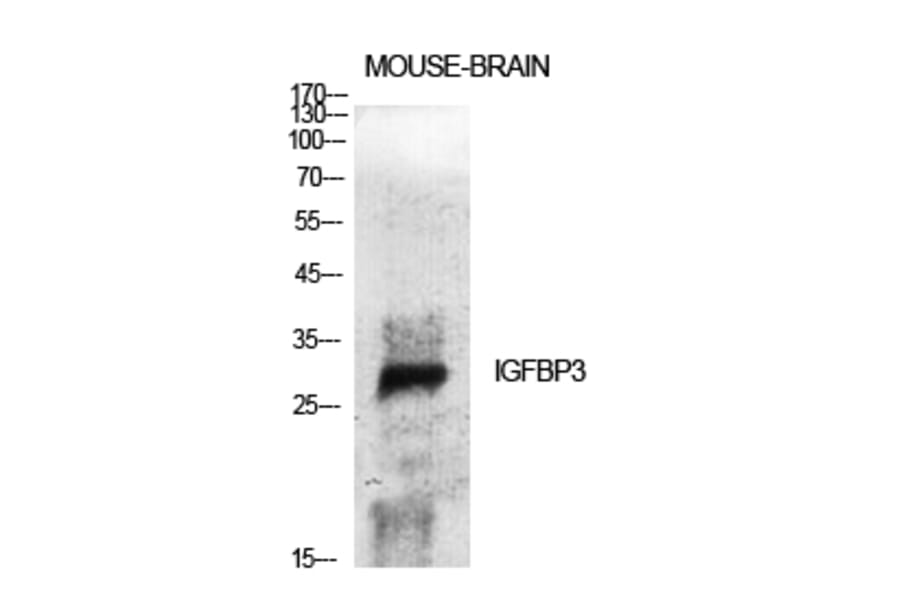 Western Blot - Anti-IGFBP-3 Antibody (B1052) - Antibodies.com