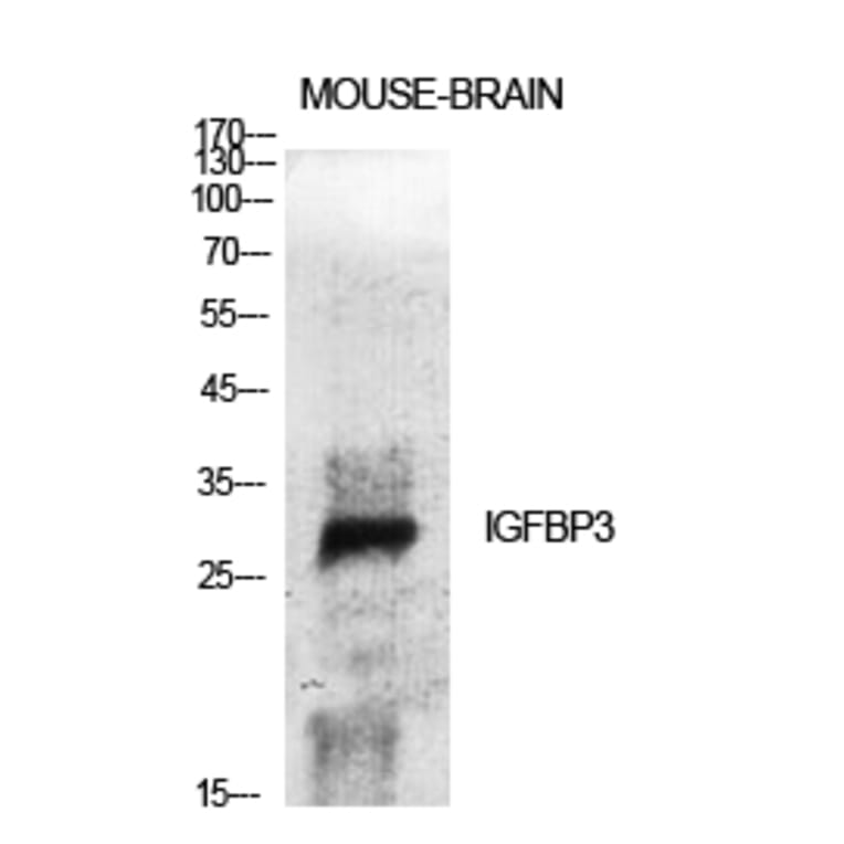 Western Blot - Anti-IGFBP-3 Antibody (B1052) - Antibodies.com