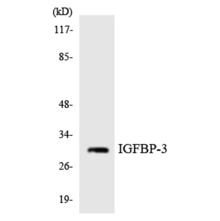 Western Blot - Anti-IGFBP-3 Antibody (R12-2914) - Antibodies.com