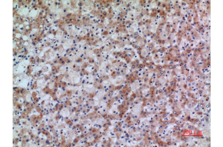 Immunohistochemistry - Anti-HSD17B4 Antibody (C30275) - Antibodies.com
