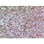 Immunohistochemistry - Anti-HSD17B4 Antibody (C30275) - Antibodies.com