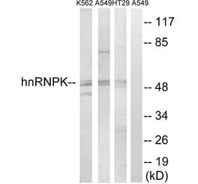 Western Blot - Anti-hnRNP K Antibody (B1042) - Antibodies.com