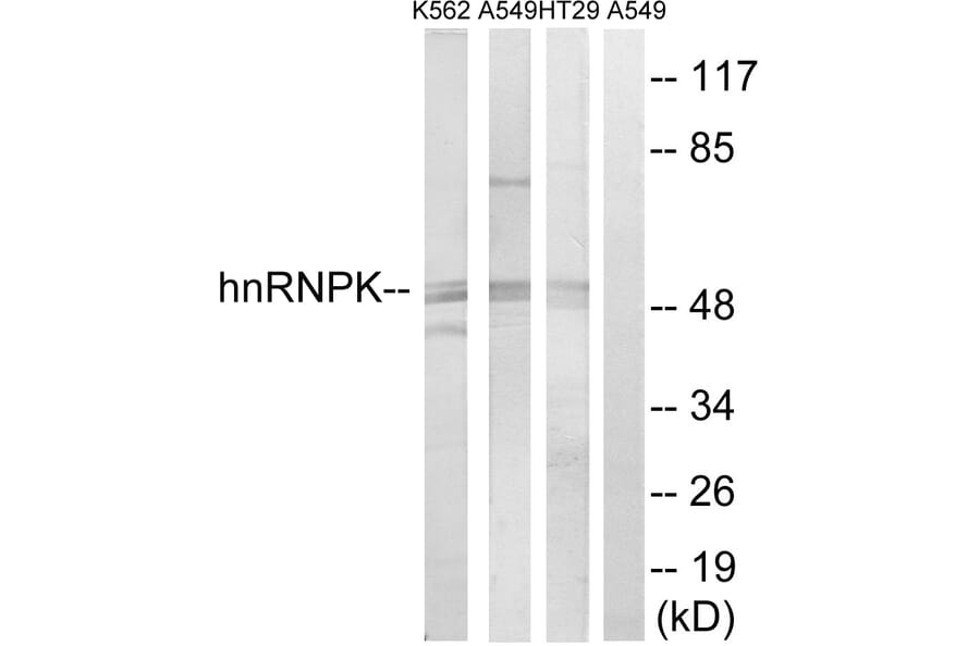 Western Blot - Anti-hnRNP K Antibody (B1042) - Antibodies.com