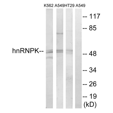 Western Blot - Anti-hnRNP K Antibody (B1042) - Antibodies.com