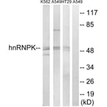 Western Blot - Anti-hnRNP K Antibody (B1042) - Antibodies.com
