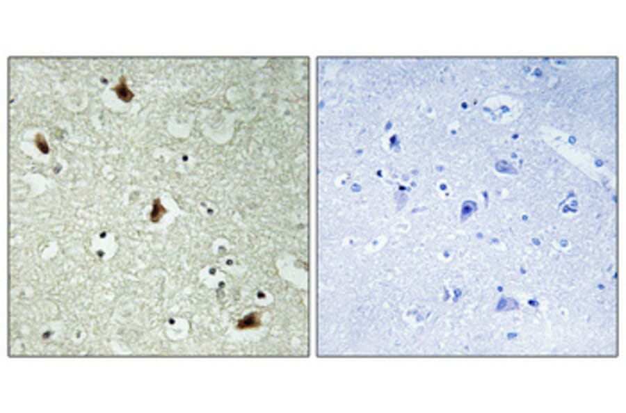 Immunohistochemistry - Anti-hnRNP K Antibody (B1042) - Antibodies.com