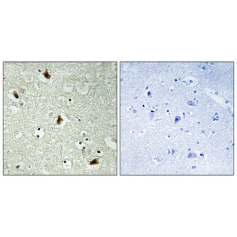 Immunohistochemistry - Anti-hnRNP K Antibody (B1042) - Antibodies.com
