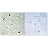 Immunohistochemistry - Anti-hnRNP K Antibody (B1042) - Antibodies.com