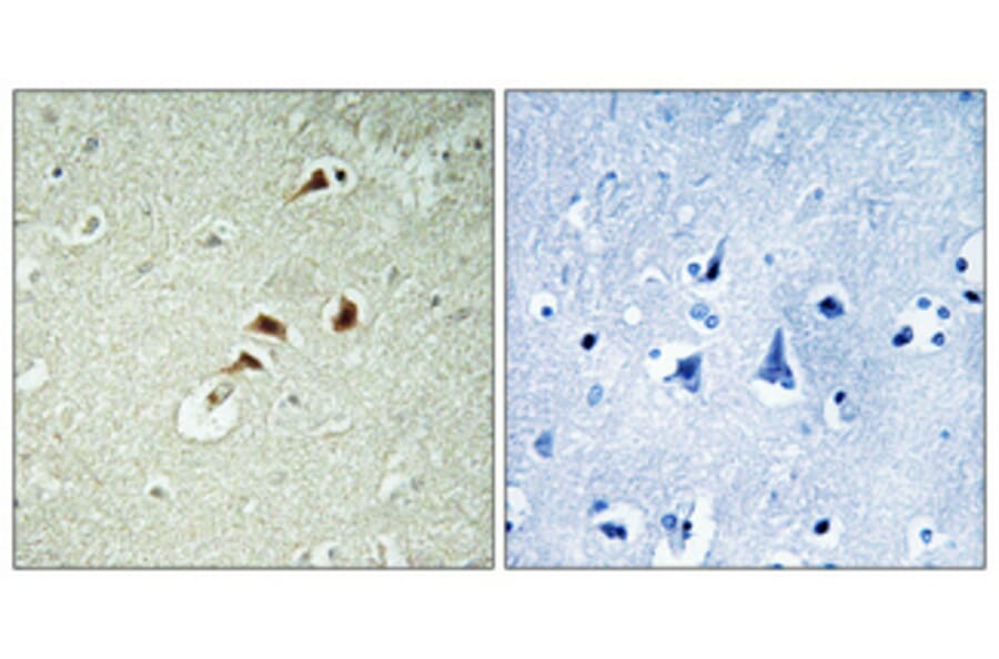 Immunohistochemistry - Anti-hnRNP K Antibody (B1042) - Antibodies.com