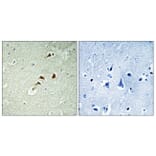 Immunohistochemistry - Anti-hnRNP K Antibody (B1042) - Antibodies.com
