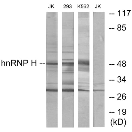 Western Blot - Anti-hnRNP H Antibody (C10747) - Antibodies.com