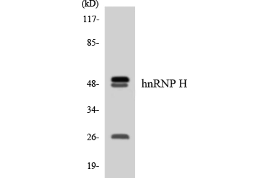 Western Blot - Anti-hnRNP H Antibody (R12-2888) - Antibodies.com