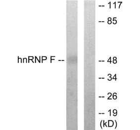 Western Blot - Anti-hnRNP F Antibody (C10700) - Antibodies.com