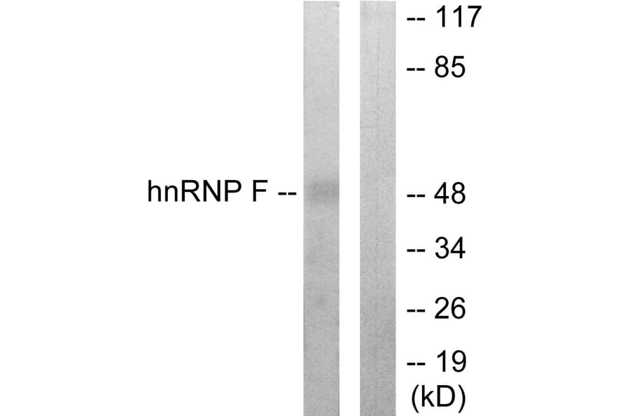 Western Blot - Anti-hnRNP F Antibody (C10700) - Antibodies.com