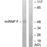 Western Blot - Anti-hnRNP F Antibody (C10700) - Antibodies.com