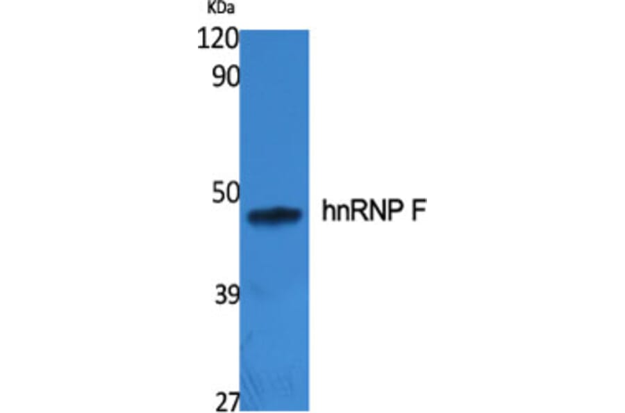 Western Blot - Anti-hnRNP F Antibody (C10700) - Antibodies.com