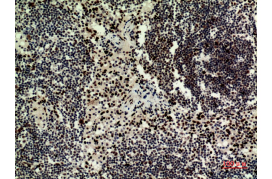Immunohistochemistry - Anti-HDGFRP3 Antibody (C30644) - Antibodies.com