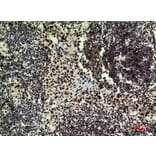 Immunohistochemistry - Anti-HDGFRP3 Antibody (C30644) - Antibodies.com