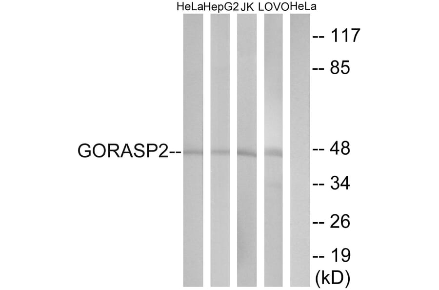 Western Blot - Anti-GORASP2 Antibody (C15940) - Antibodies.com