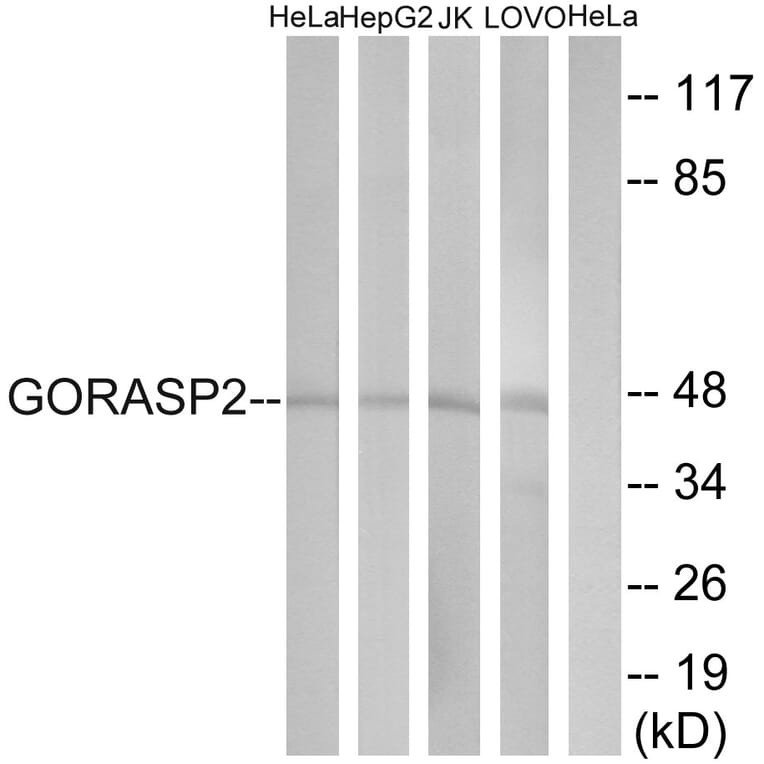 Western Blot - Anti-GORASP2 Antibody (C15940) - Antibodies.com
