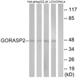 Western Blot - Anti-GORASP2 Antibody (C15940) - Antibodies.com