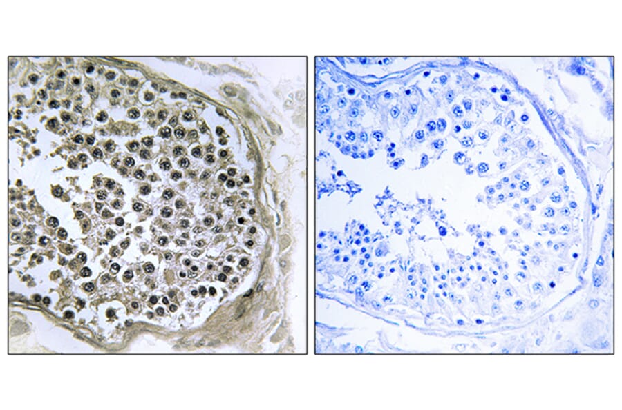 Immunohistochemistry - Anti-GIDRP88 Antibody (C15980) - Antibodies.com