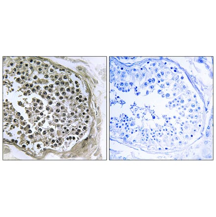 Immunohistochemistry - Anti-GIDRP88 Antibody (C15980) - Antibodies.com