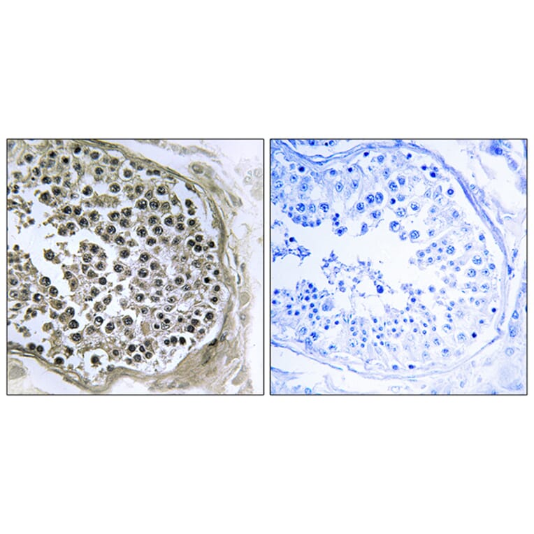 Immunohistochemistry - Anti-GIDRP88 Antibody (C15980) - Antibodies.com