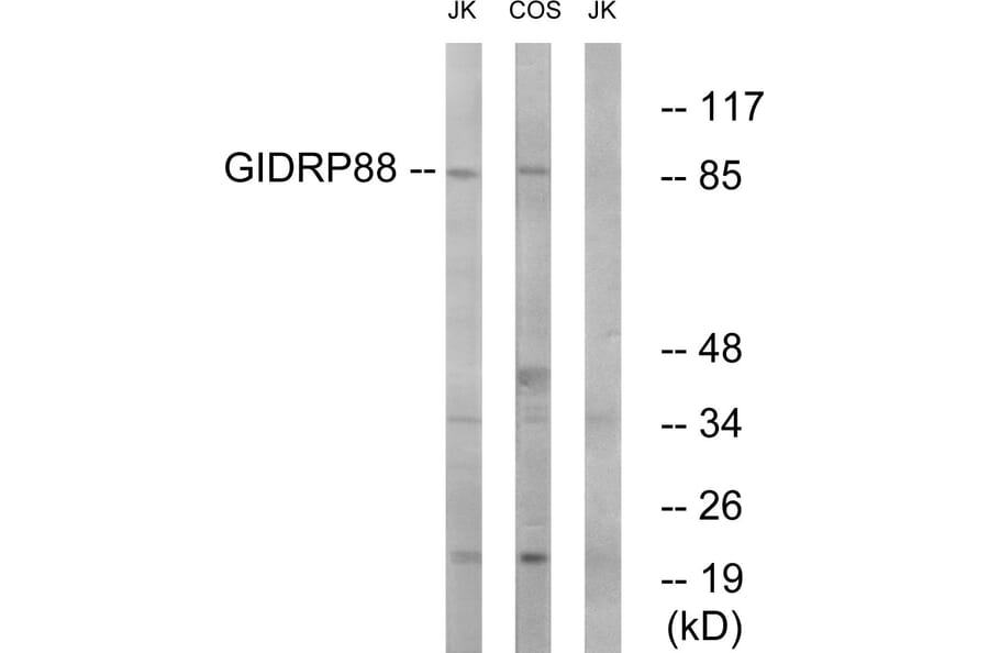 Western Blot - Anti-GIDRP88 Antibody (C15980) - Antibodies.com
