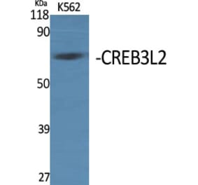 Western Blot - Anti-CREB3L2 Antibody (C20601) - Antibodies.com