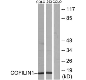 Western Blot - Anti-Cofilin Antibody (B7047) - Antibodies.com