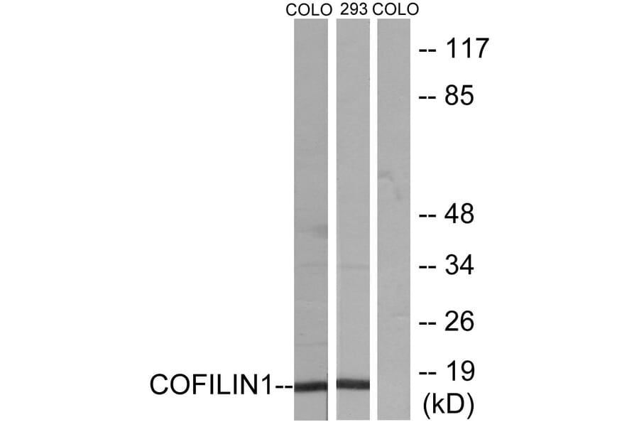 Western Blot - Anti-Cofilin Antibody (B7047) - Antibodies.com