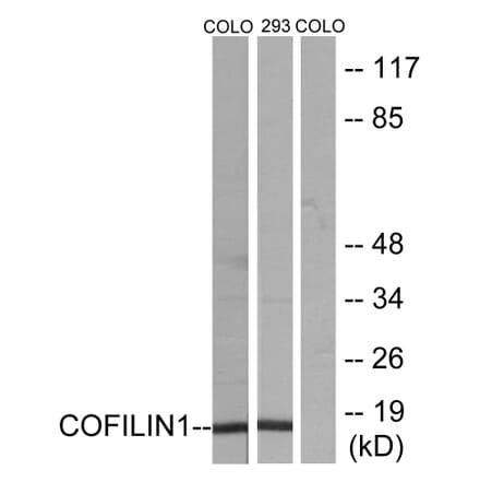 Western Blot - Anti-Cofilin Antibody (B7047) - Antibodies.com