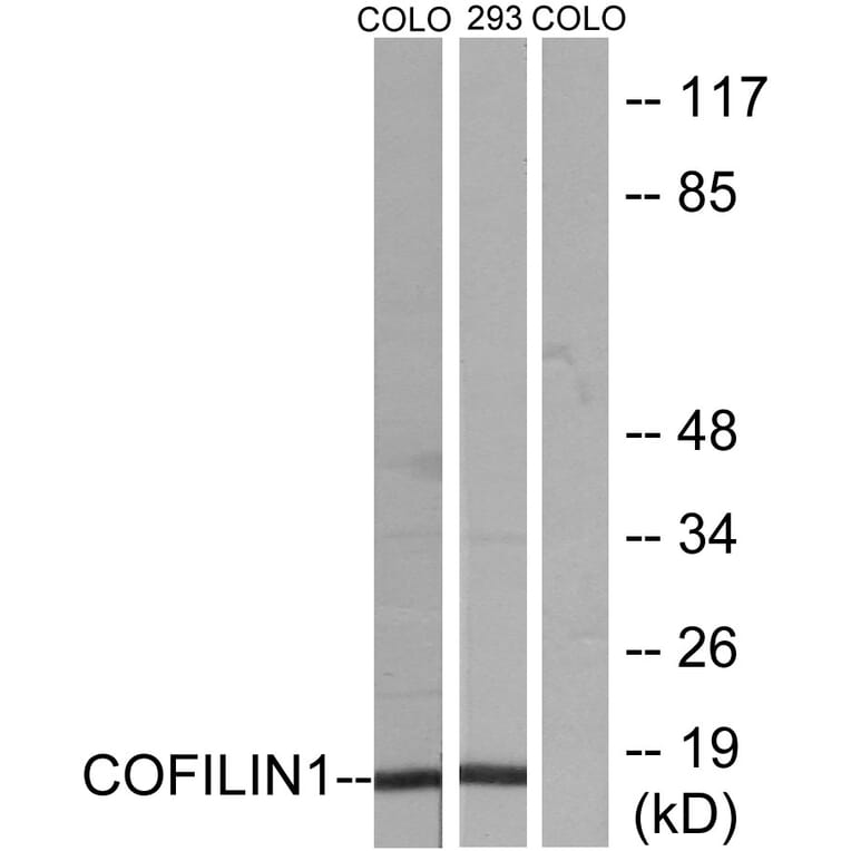 Western Blot - Anti-Cofilin Antibody (B7047) - Antibodies.com