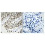 Immunohistochemistry - Anti-Cofilin Antibody (B7047) - Antibodies.com