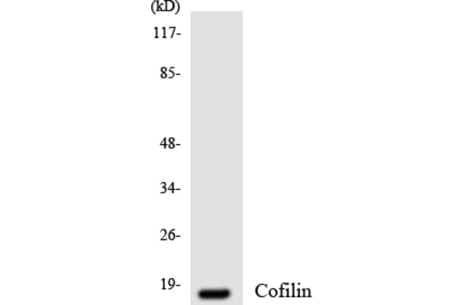 Western Blot - Anti-Cofilin Antibody (R12-2640) - Antibodies.com