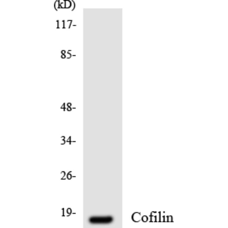 Western Blot - Anti-Cofilin Antibody (R12-2640) - Antibodies.com