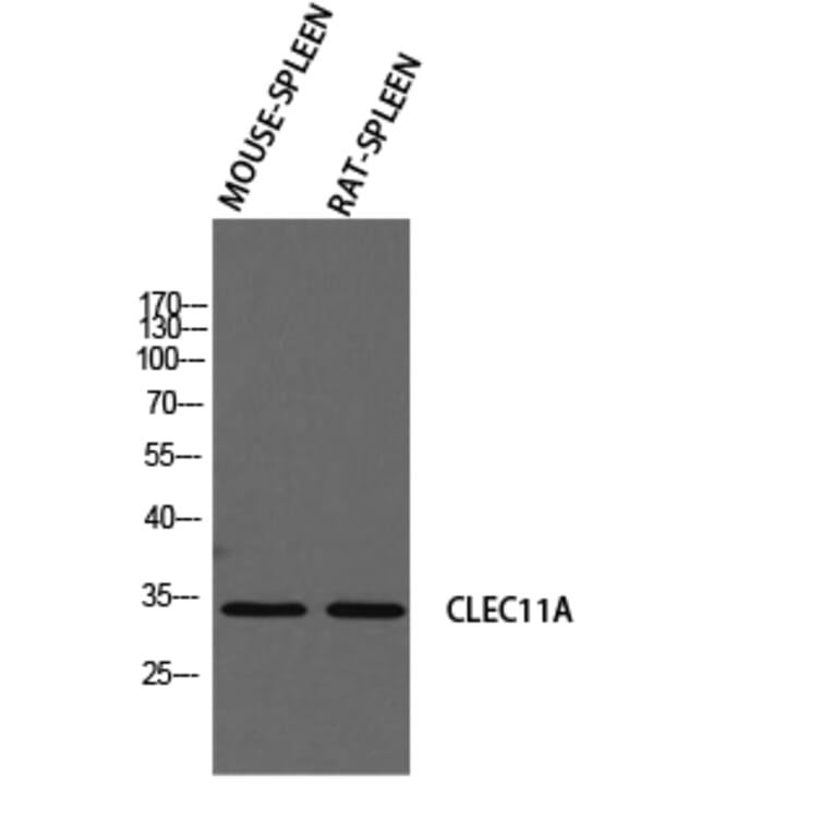 Western Blot - Anti-CLEC11A Antibody (C30599) - Antibodies.com