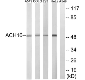 Western Blot - Anti-CHRNA10 Antibody (C16982) - Antibodies.com
