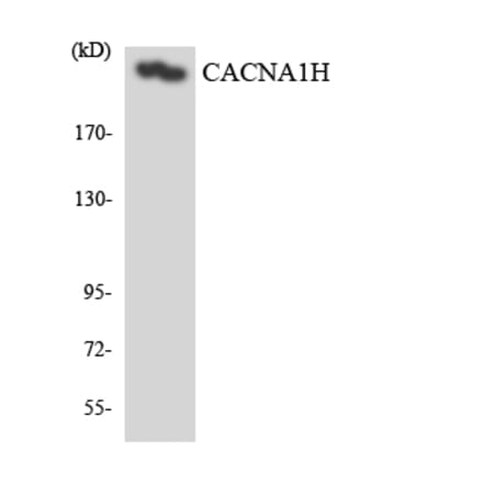Western Blot - Anti-CACNA1H Antibody (R12-2560) - Antibodies.com