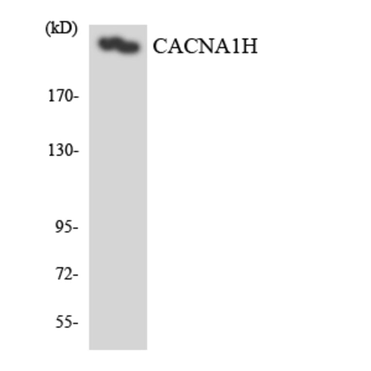 Western Blot - Anti-CACNA1H Antibody (R12-2560) - Antibodies.com